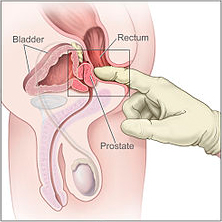 Pelvic Muscle Weakness